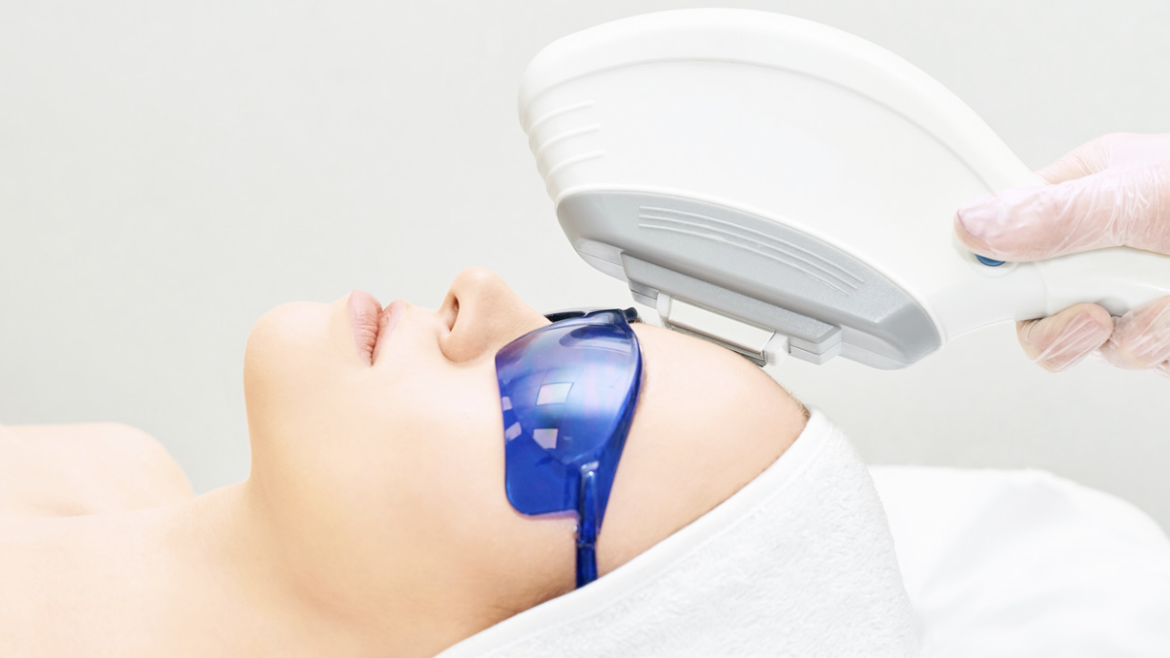 Intense Pulsed Light (IPL) for Photofacial and Pigmentation Issues